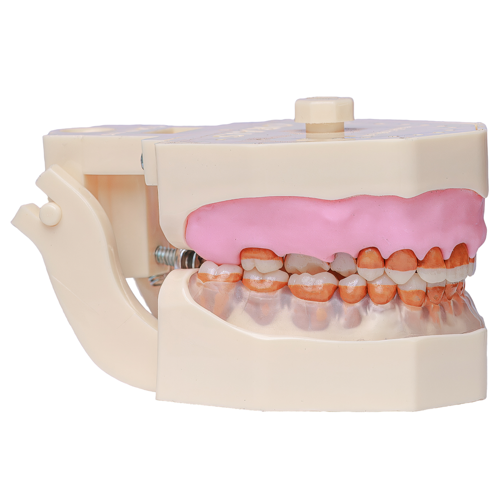 MNQ DE PERIODONTIA FG PALATO (3096)