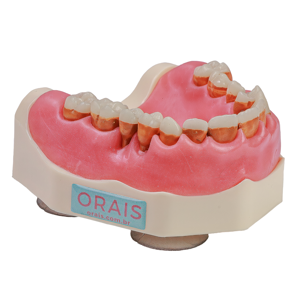 MNQ PERIO FG SUPERIOR (3098)