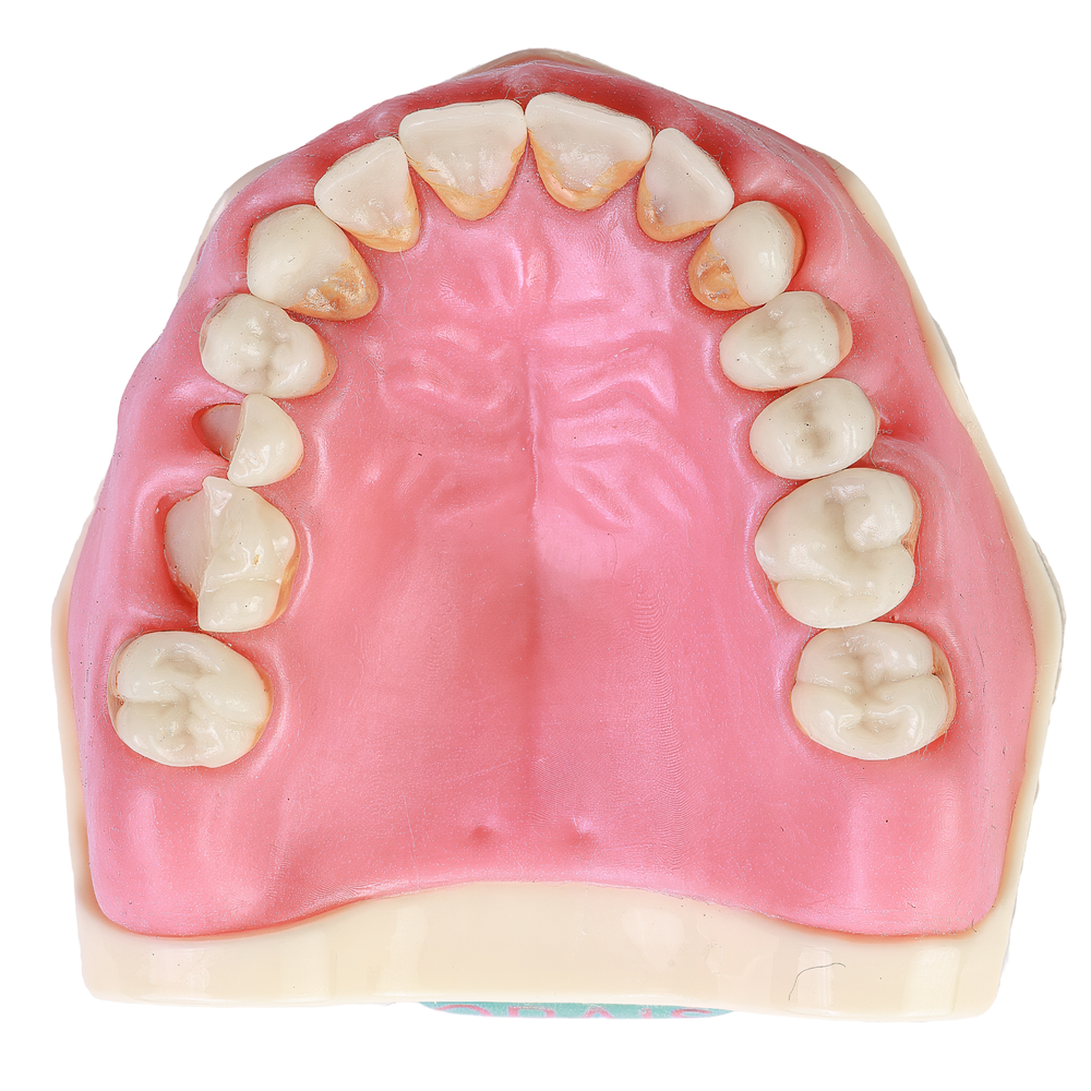 MNQ PERIO FG SUPERIOR (3098)