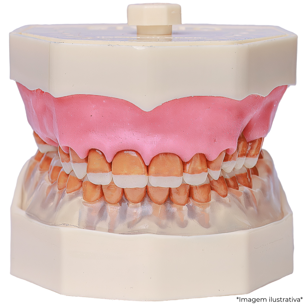MNQ DE PERIODONTIA FMU (311)