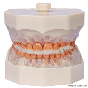 MNQ DE PERIO (Ñ TROCA DENTE) (310)