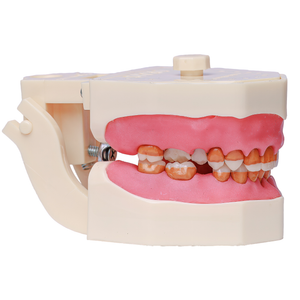 MANEQUIM CIRURGIA C/ DENTES DE PERIODONTIA  (315)
