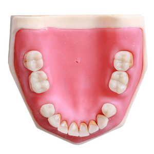 MANEQUIM CIRURGIA C/ DENTES DE PERIODONTIA  (315)