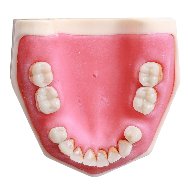 MANEQUIM CIRURGIA C/ DENTES DE PERIODONTIA  (315)