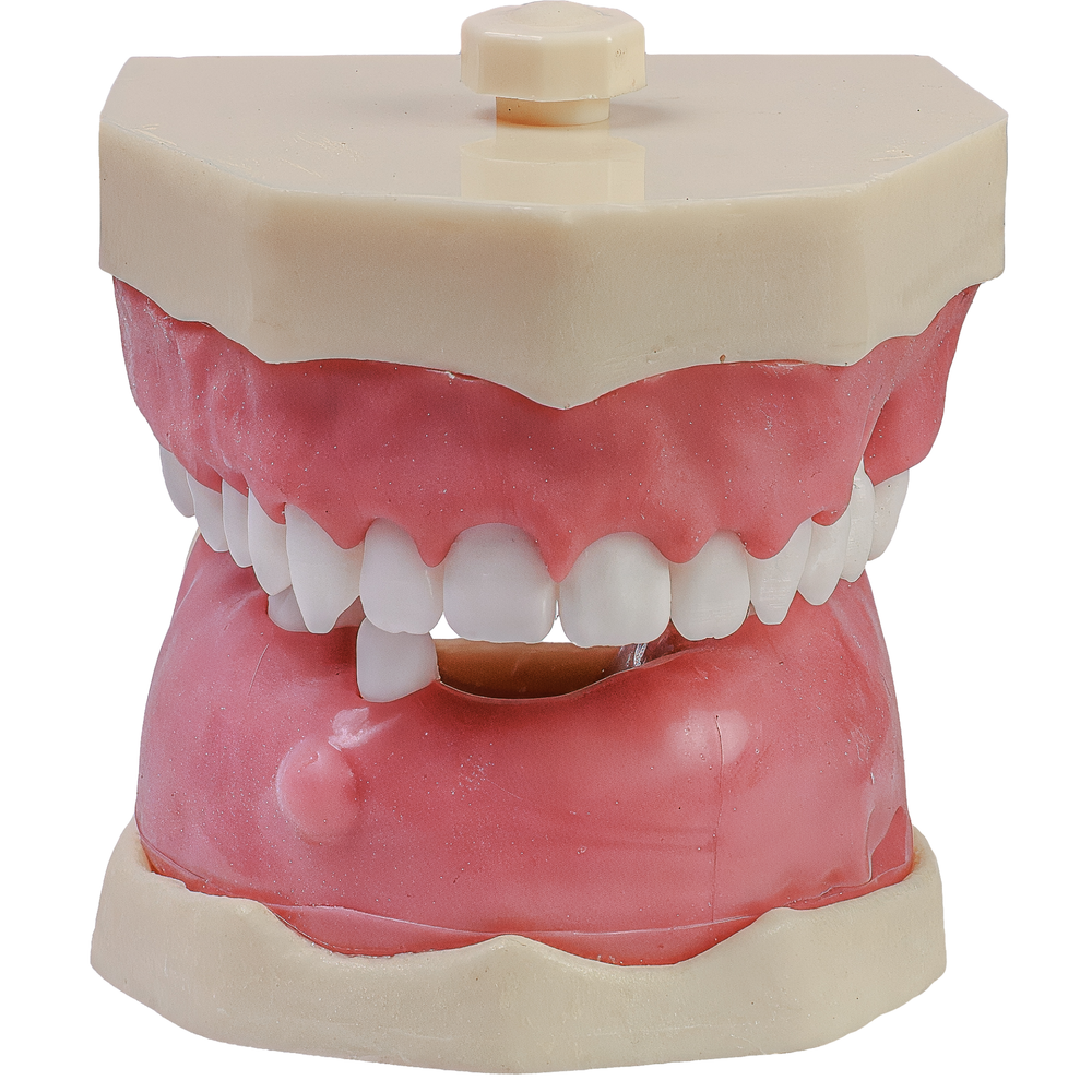 MNQ Cirurgia INF/dentes de raiz anatomica SUP (318)