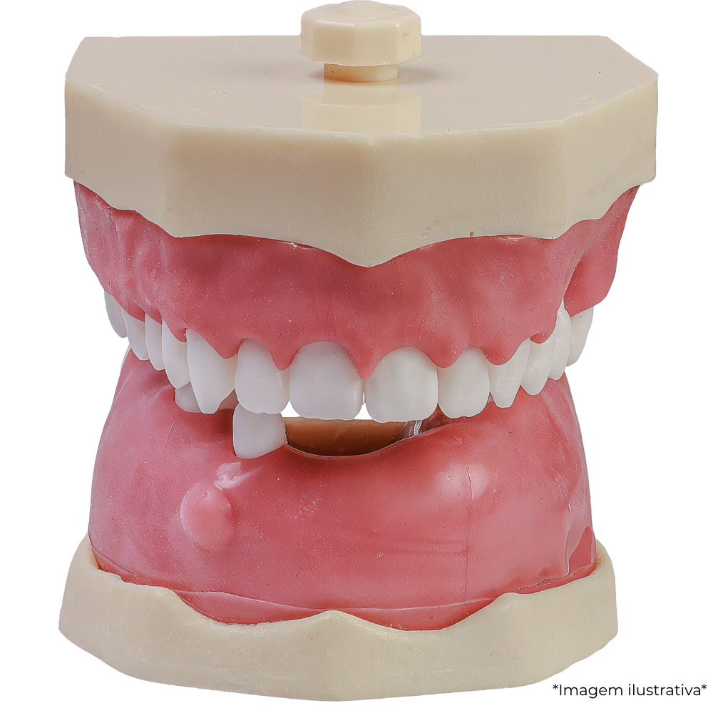MNQ PERIODONTIA FG/CIRURGIA (3099)