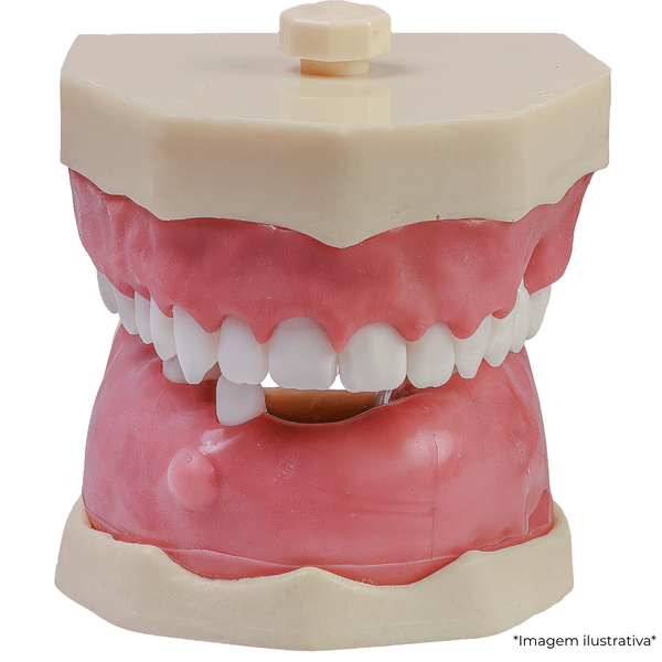 MNQ PERIODONTIA FG/CIRURGIA (3099)