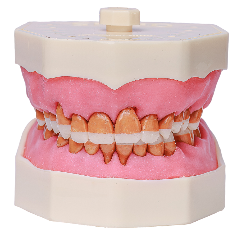 MNQ Cir c/ dentes de Perio - travamento mole (319)