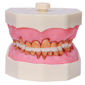 MNQ Cir c/ dentes de Perio - travamento mole (319)