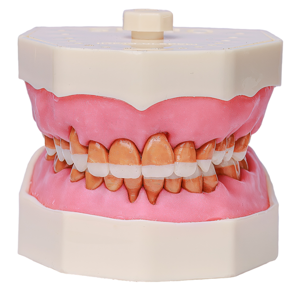 MNQ Cir c/ dentes de Perio - travamento mole (319)