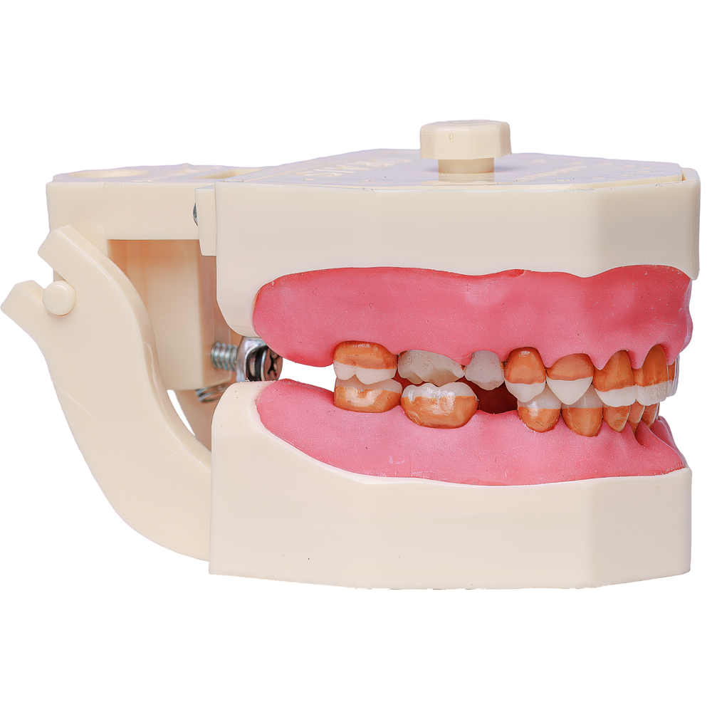 MNQ Cir c/ dentes de Perio - travamento mole (319)