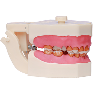 MNQ Cir c/ dentes de Perio - travamento mole (319)