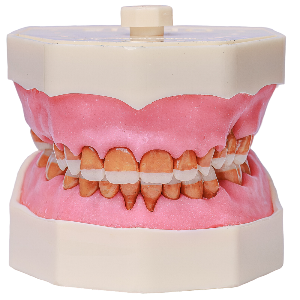 MNQ Cirurgia dentes antômicos - sup.309, inf.315 (323)