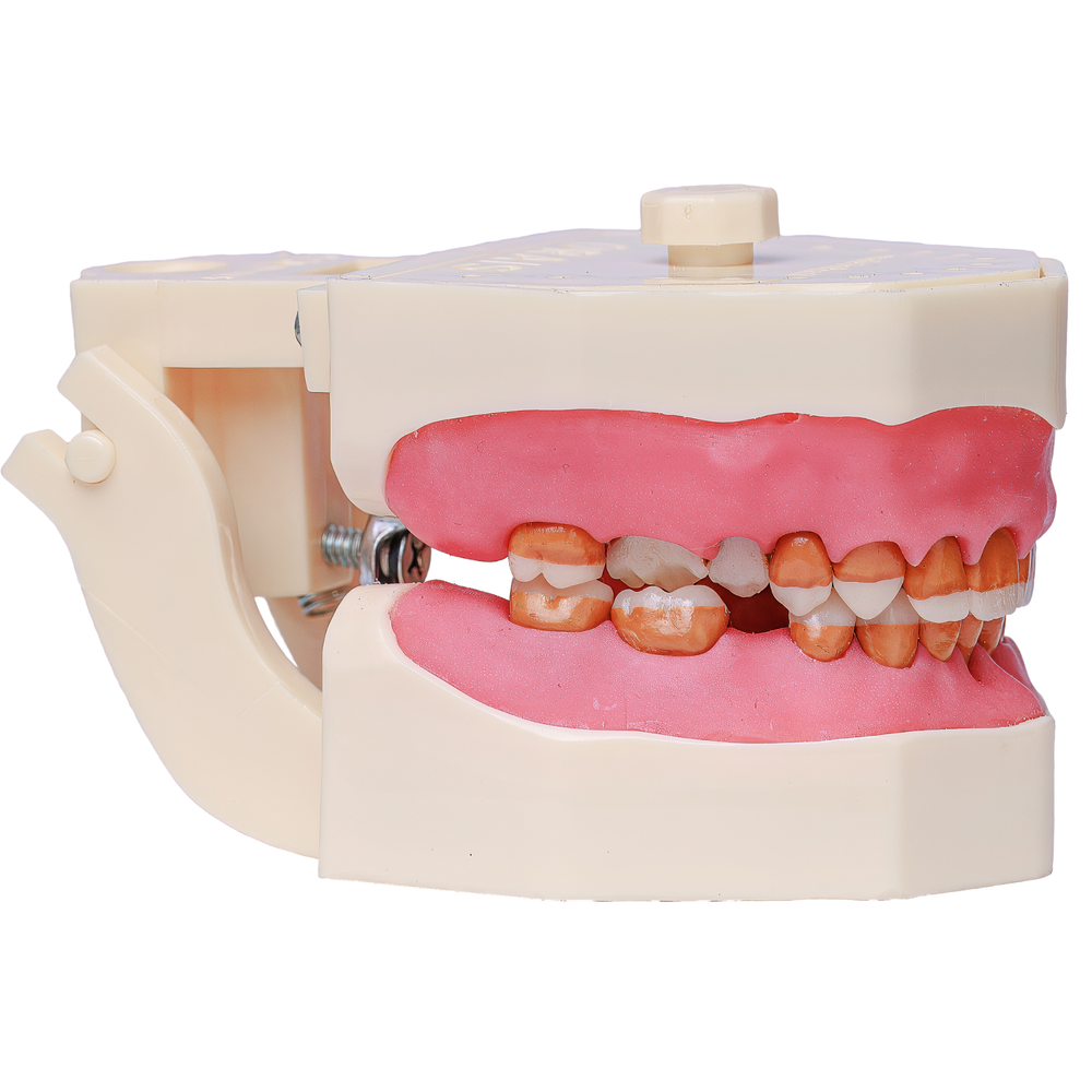 MNQ Cirurgia dentes antômicos - sup.309, inf.315 (323)