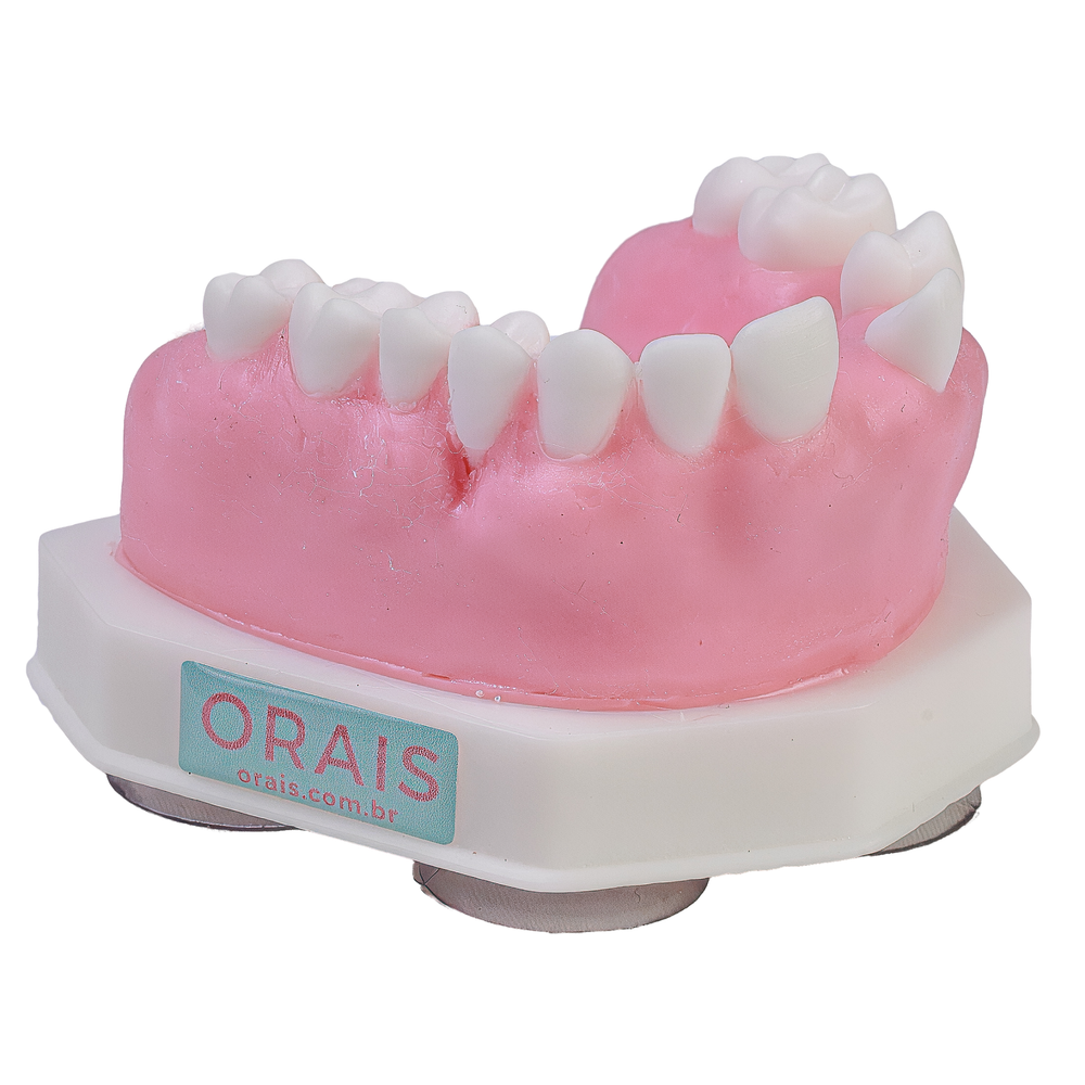 MNQ DE PERI-IMPLANTITE (324)