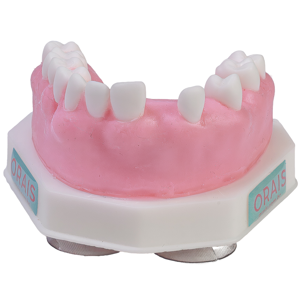 MNQ DE PERI-IMPLANTITE (324)