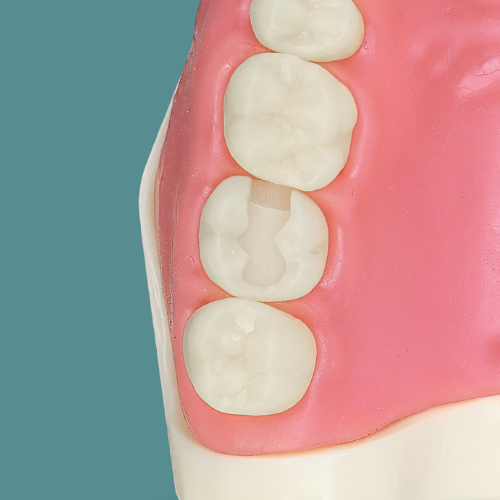 Dente Orais preparado