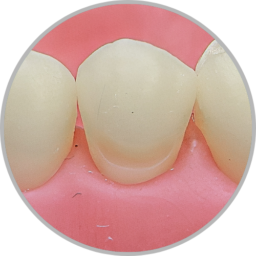 Dente 35 - Classe V (V) (cod:35.H)