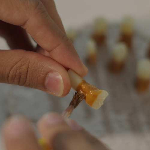 Detalhe da tinta calibrada nos dentes do manequim Orais simulando cálculo dental