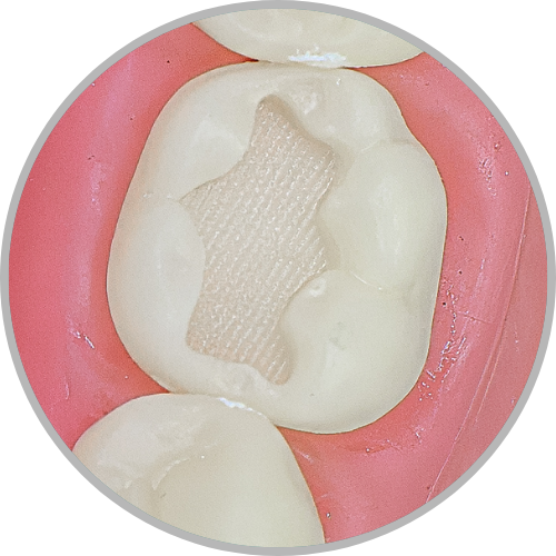 Dente 36 - Classe I (O) (cod:36.A)