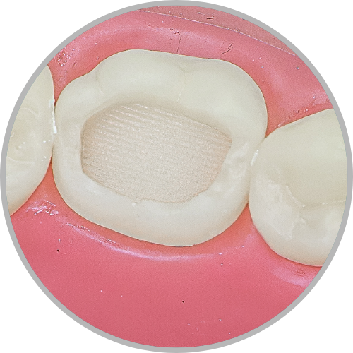 Dente 36 - Classe I (O) extensa (cod:36.B)