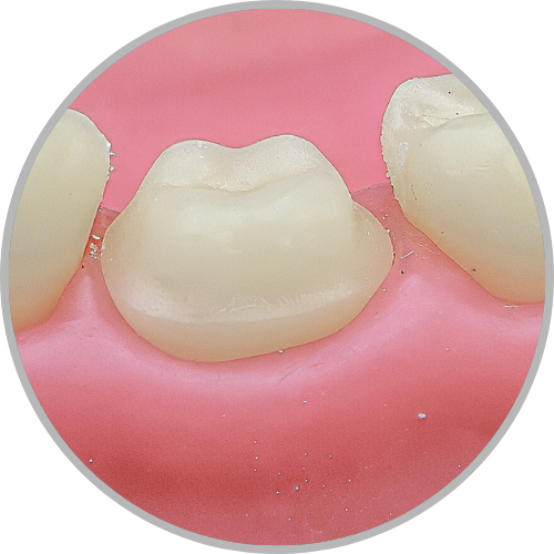 Dente 36 - Anatomia dental / Morfologia (cod:36.N)