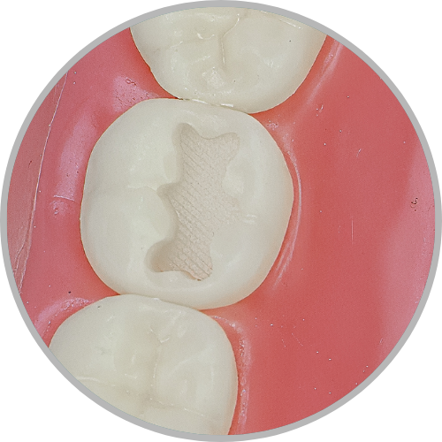 Dente 37 - Classe I (O) (cod:37.A)