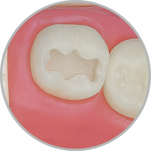 Dente 38 - Classe I (O) (cod:38.A)