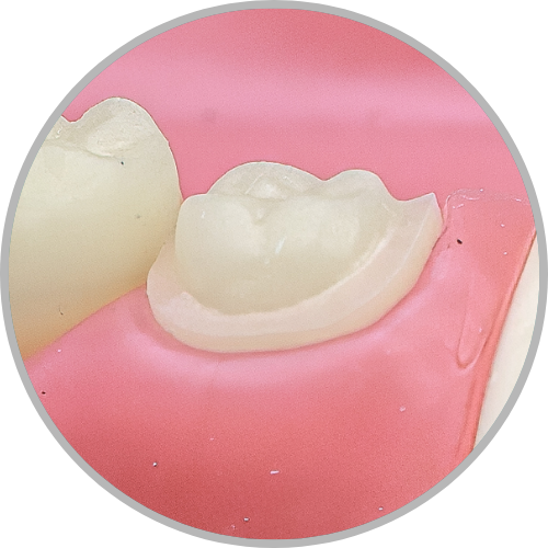 Dente 38 - Coroa Total (cod:38.B)