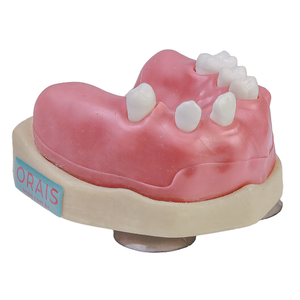 MNQ CIRURGIA- SUPERIOR/MAXILA (404)