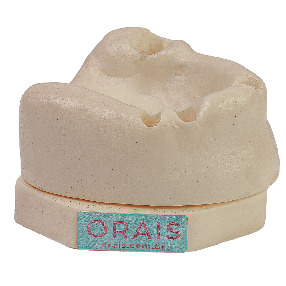 MNQ LEVANTAMENTO DE SEIO (410)