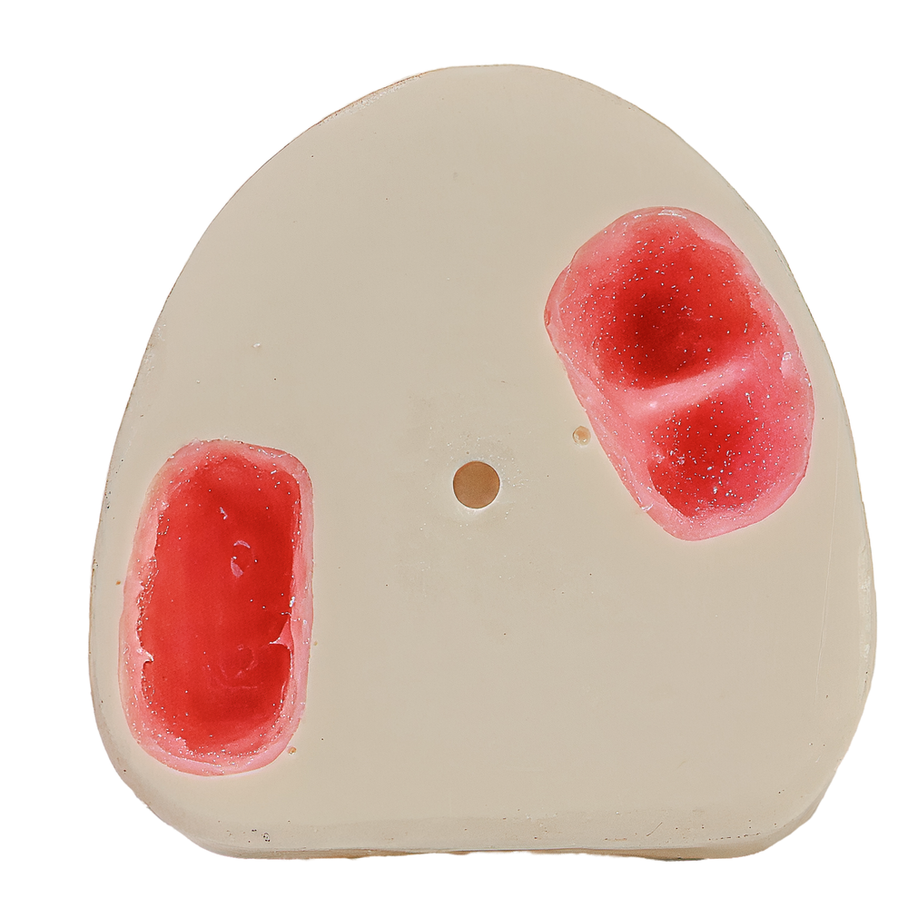 MNQ LEVANTAMENTO DE SEIO (410)