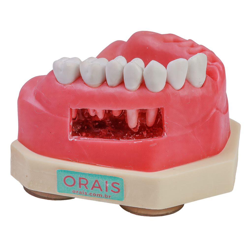 MNQ CIRURGIA PARAENDODONTICA (411)