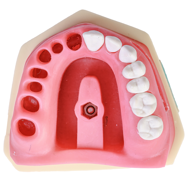 MNQ CIRURGIA PARAENDODONTICA (411)