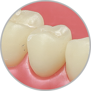 Dente 44 - Hígido (cod:44.0)
