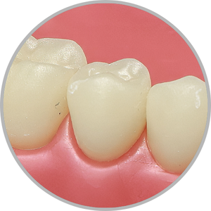 Dente 45 - Hígido (cod:45.0)
