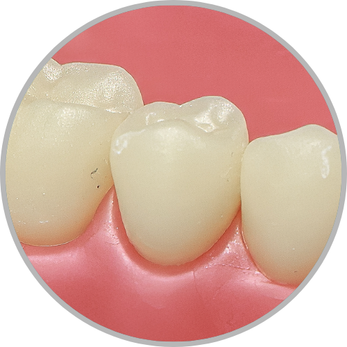 Dente 45 - Hígido (cod:45.0)