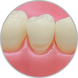 Dente 45 - Classe V (V) (cod:45.C)