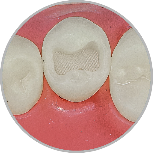 Dente 45 - Classe I (O) (cod:45.D)