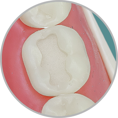 Dente 46 - Classe I (O) (cod:46.A)