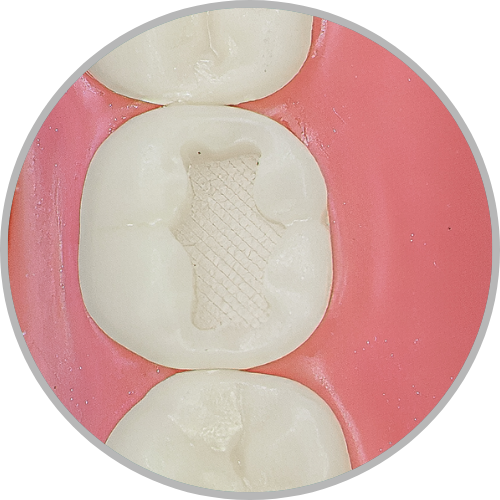 Dente 47 - Classe I (O) (cod:47.A)