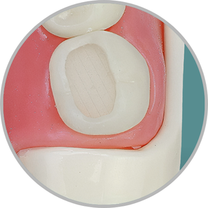 Dente 48 - Classe I (O) extensa (cod:48.A)