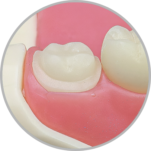 DENTE PREPARADO 48.E