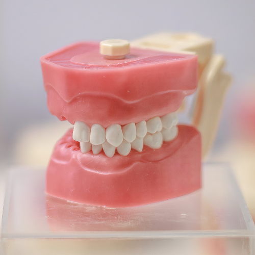 Manequim de Endodontia Orais com Dentes Artificiais montados na arcada — sistema completo de treinamento