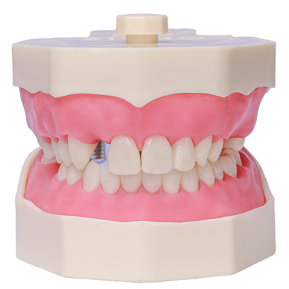 MNQ PROTESE PARCIAL 702 (702)