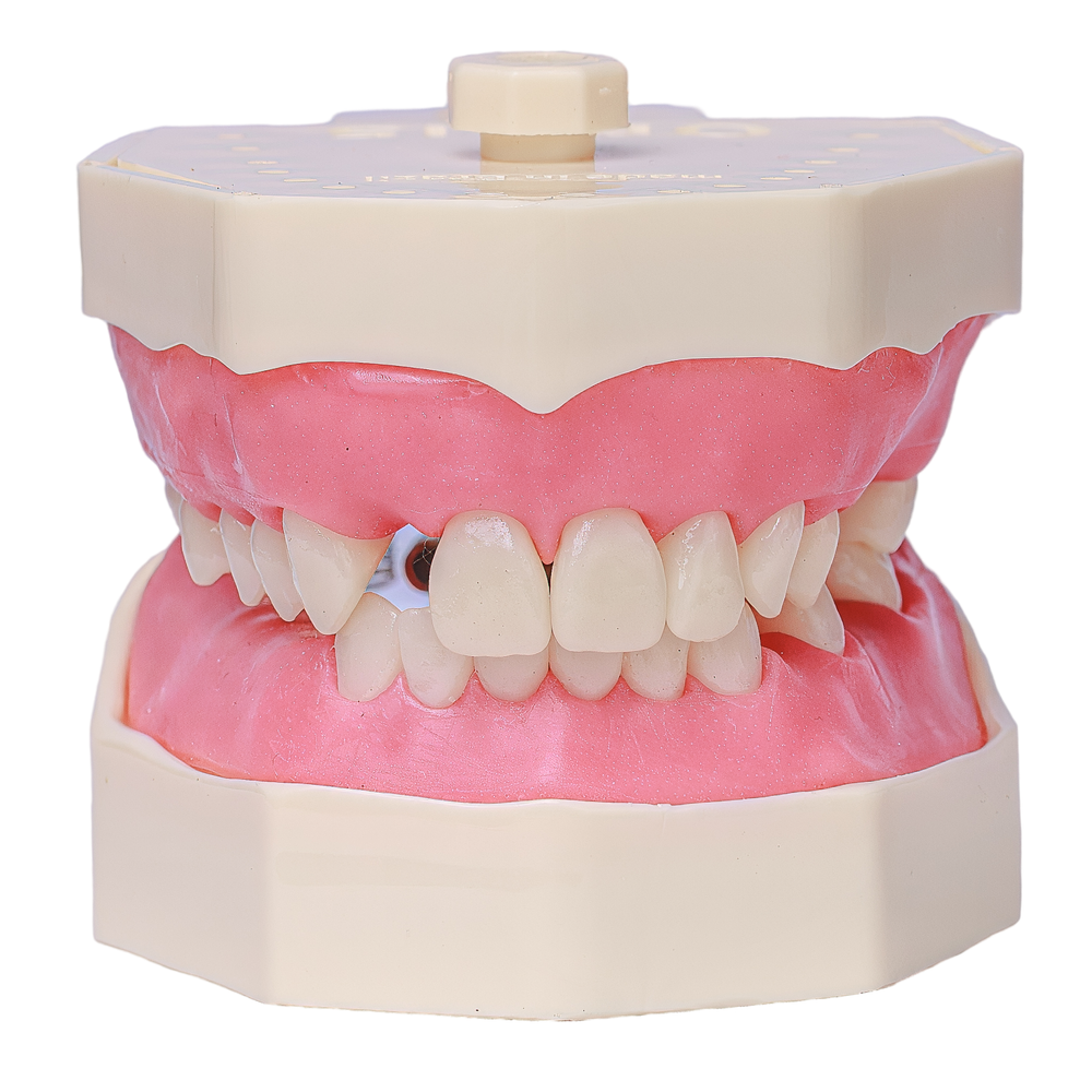 MNQ PROTESE PARCIAL (705)