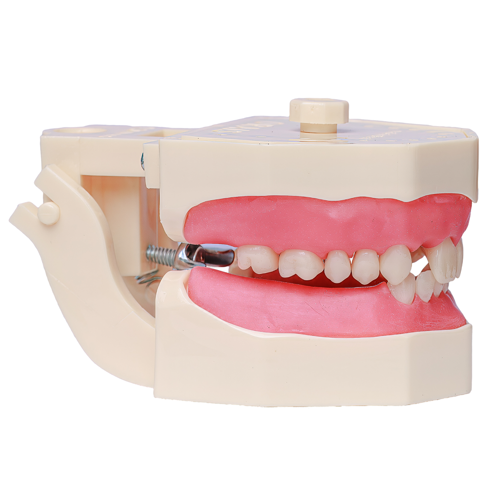 MNQ PROTESE PARCIAL (705)