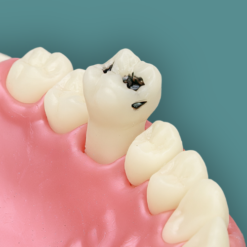 Dente artificial Orais em close