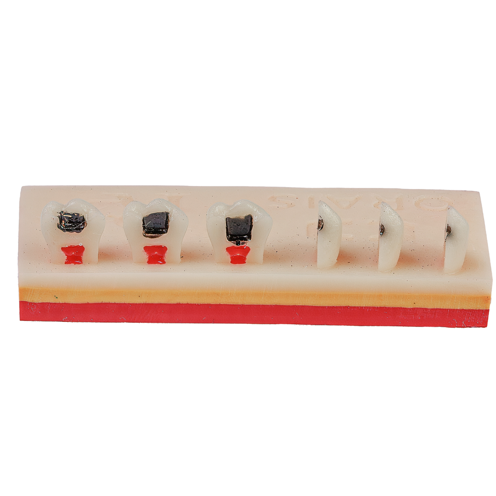 Sequência de Camadas R2 (903)