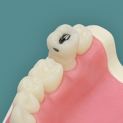 Variações de dentes preparados Orais para Manequim de Materiais Dentários